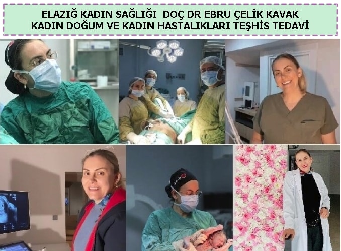 Elaz kadn sal uzman doktor kadn doum uzman